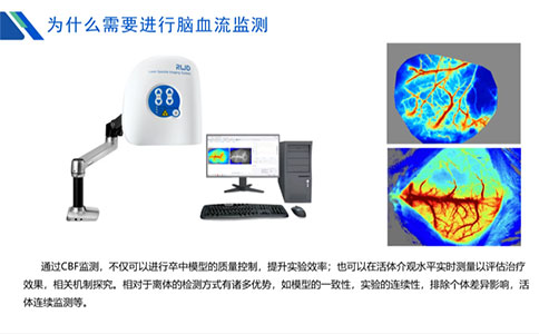 为什么需要进行脑血流监测？